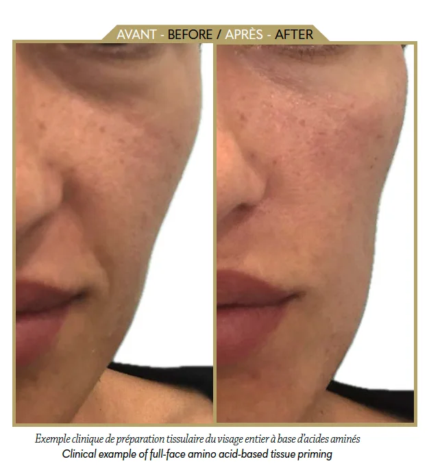 Advancing Aesthetic Medicine: The Role of Biological Priming in Facial Rejuvenation