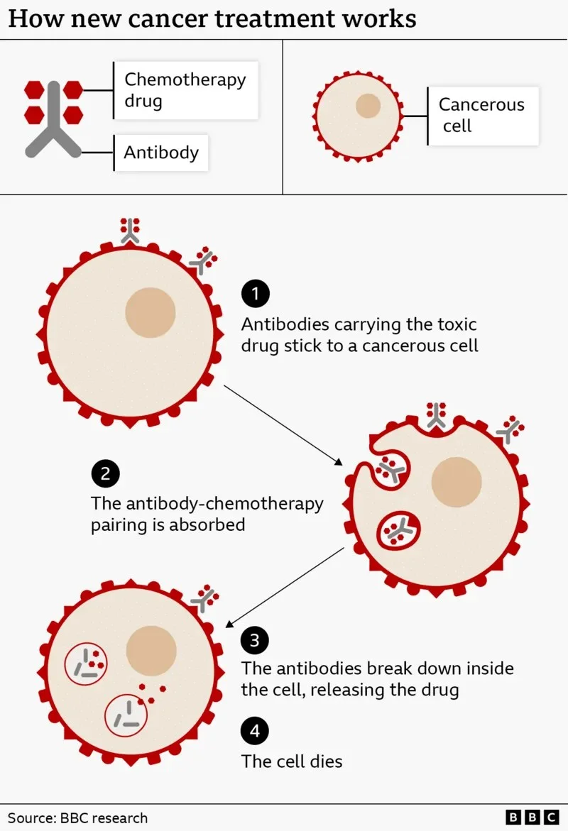 Ovarian Cancer: This Targeted Treatment is Already Changing the Game for Many Patients